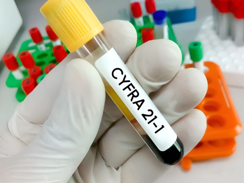 dinh-luong-cyfra-21-1-2