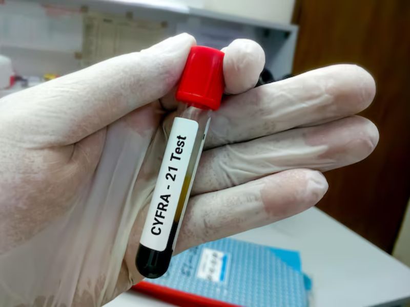 cyfra-21-1-duong-tinh-gia-1