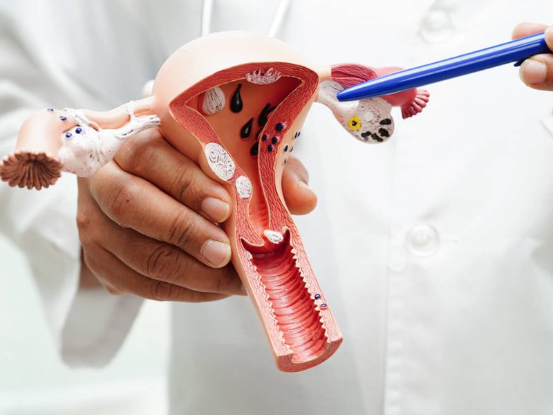 ung-thu-co-tu-cung-song-duoc-bao-lau-2