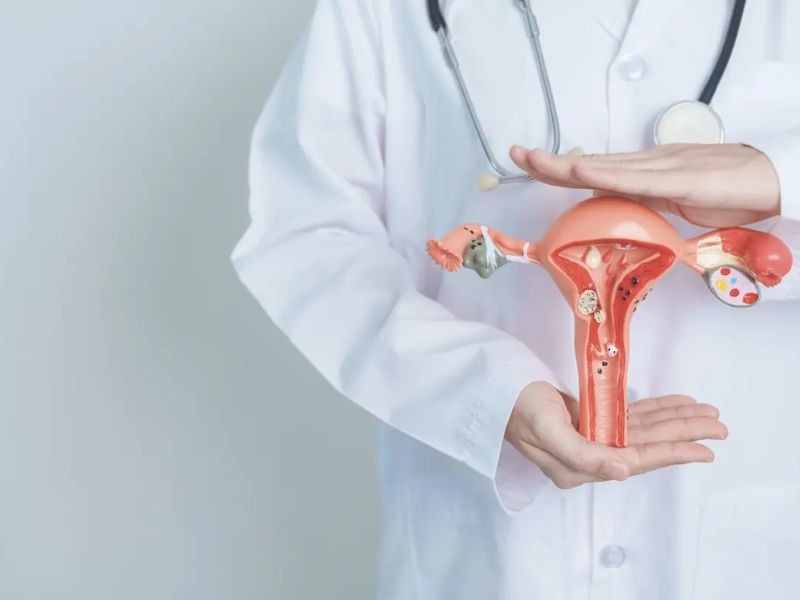 tam-soat-ung-thu-co-tu-cung-4