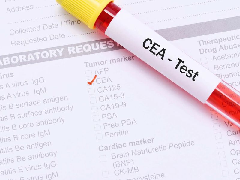 cach-giam-chi-so-cea-trong-mau-1