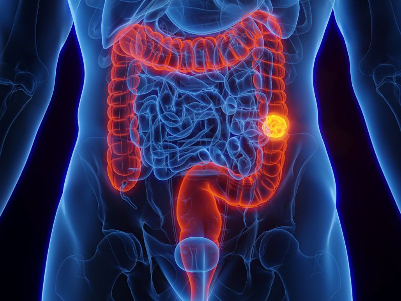 cea-tang-trong-truong-hop-nao-1