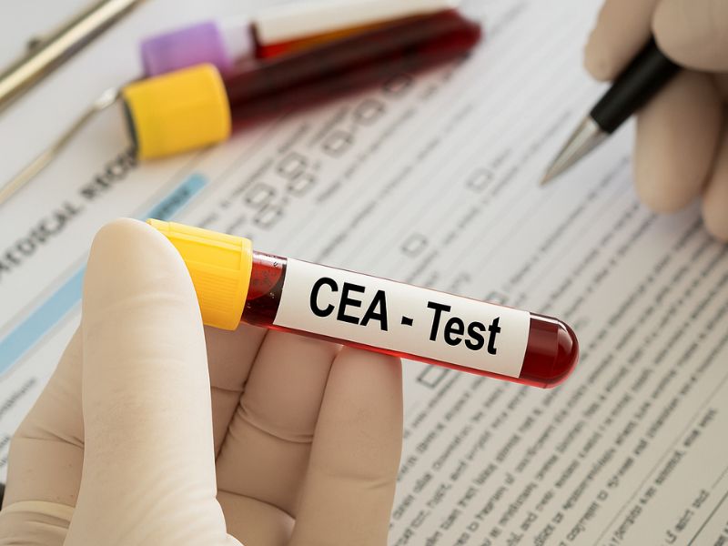 cea-tang-trong-truong-hop-nao-3