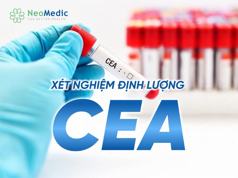 cea-tang-trong-truong-hop-nao-5