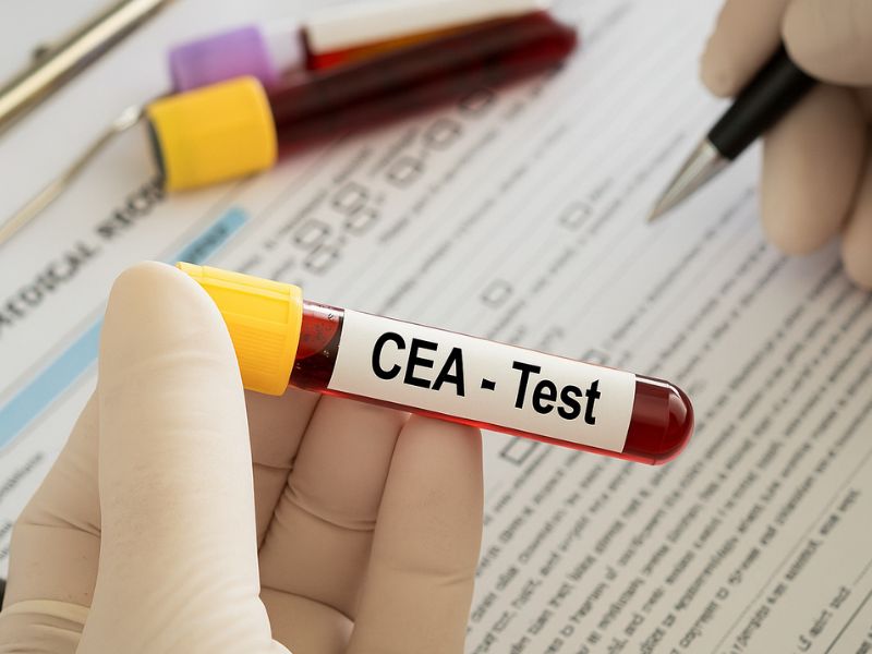 cach-giam-chi-so-cea-trong-mau-2