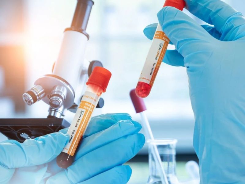 cach-giam-chi-so-cea-trong-mau-3