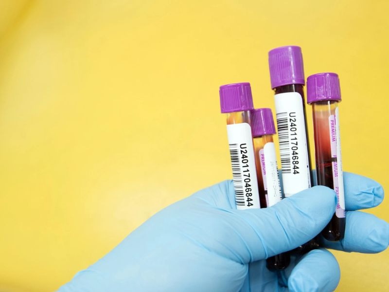 ca-125-tang-trong-truong-hop-nao-3