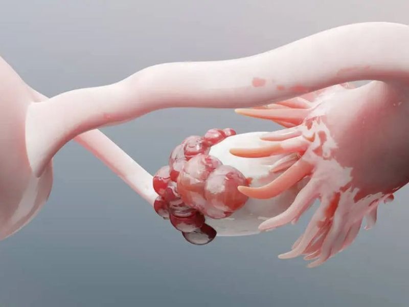 ca-125-tang-trong-truong-hop-nao-2