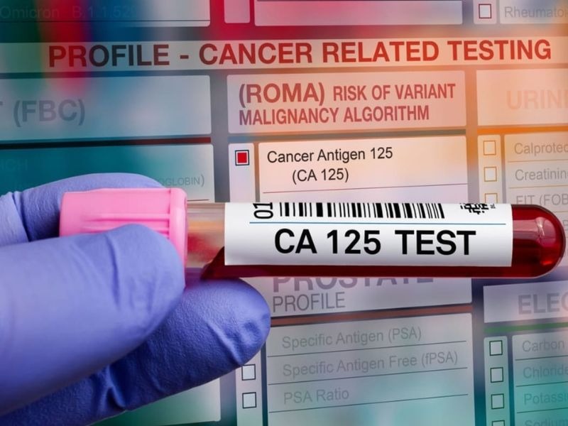 ca-125-tang-trong-truong-hop-nao-1