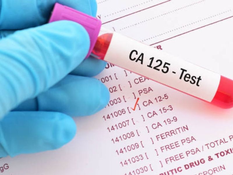 ca-125-tang-trong-truong-hop-nao-4