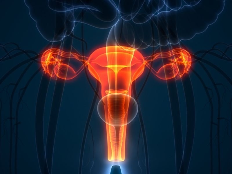 chi-phi-khoet-chop-co-tu-cung-2