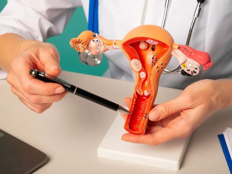 khoet-chop-co-tu-cung-bang-vong-dien-nhiet-6