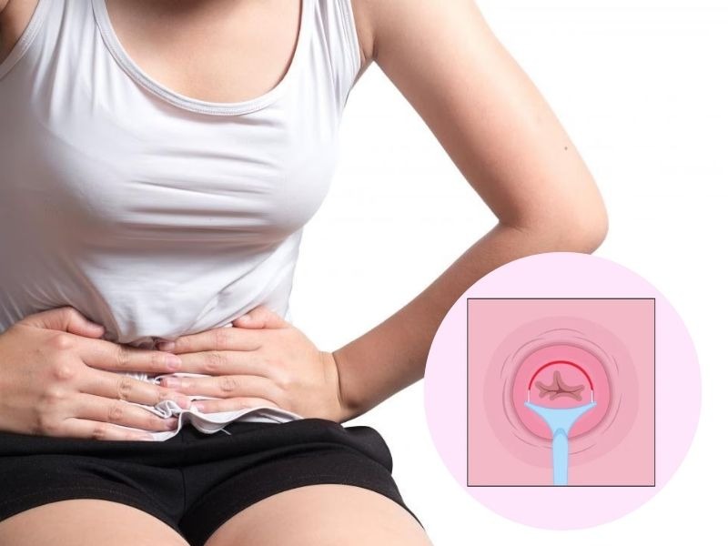 khoet-chop-co-tu-cung-co-thai-duoc-khong-2