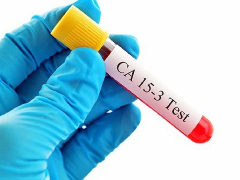 dinh-luong-ca-15-3-1