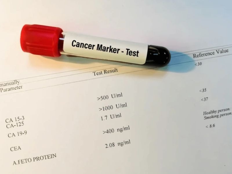 dinh-luong-ca-15-3-4