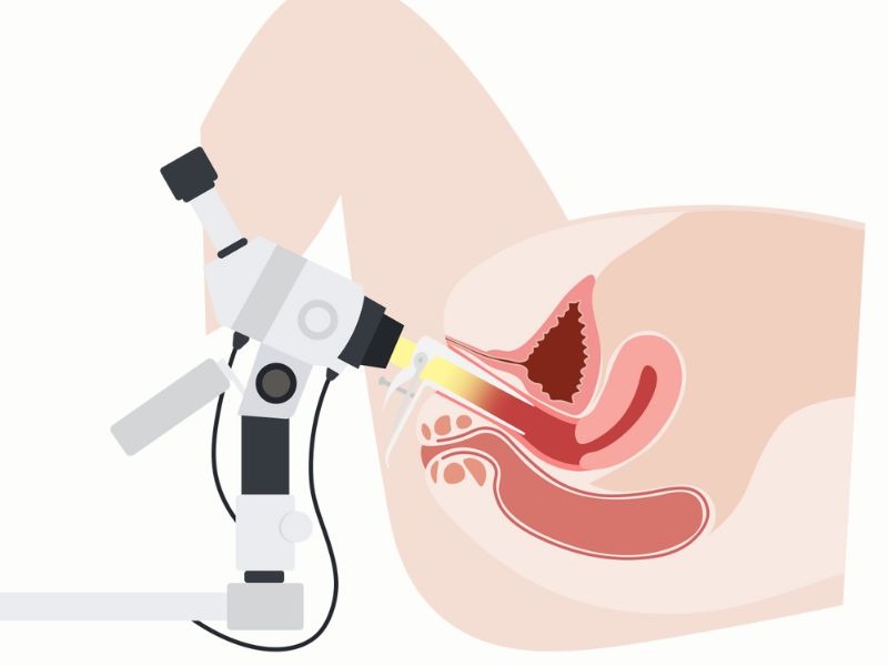 chua-quan-he-co-soi-co-tu-cung-duoc-khong-2