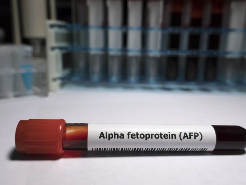 dinh-luong-AFP-la-gi-2