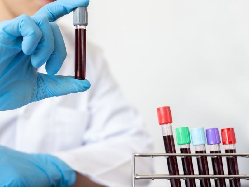 chi-so-afp-trong-mau-cao-4