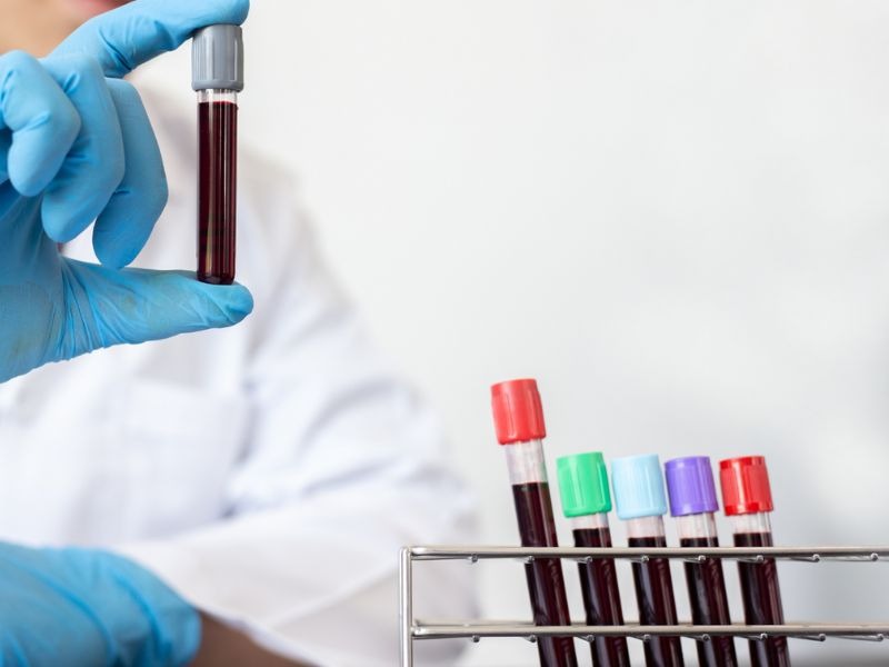 dinh-luong-AFP-la-gi-3