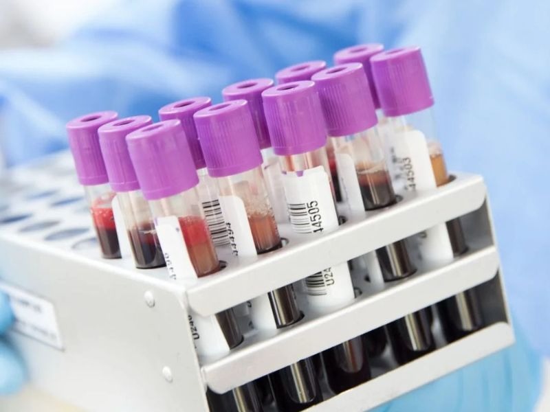 dinh-luong-AFP-la-gi-5