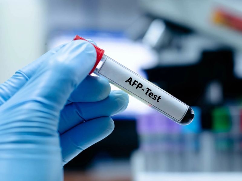 dinh-luong-AFP-la-gi-4