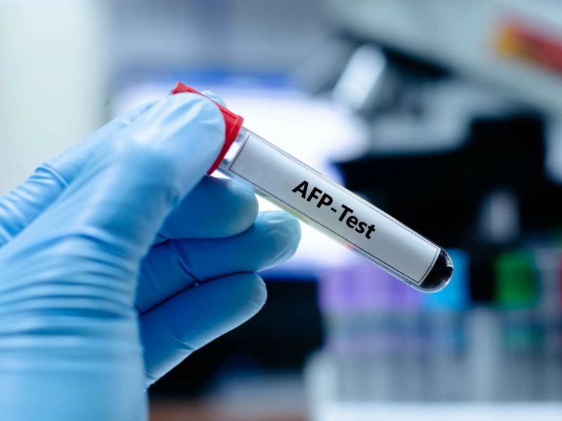 chi-so-afp-trong-mau-cao-7