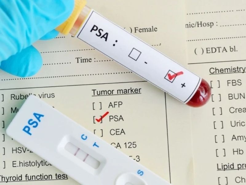 dinh-luong-psa-toan-phan-4