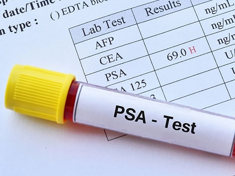 cach-lam-giam-chi-so-psa-4