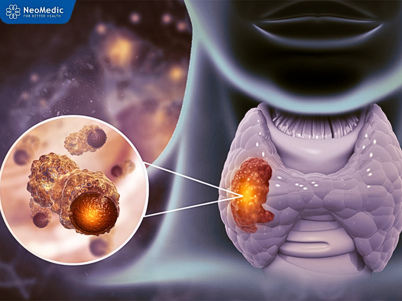 tam-soat-ung-thu-bao-lau-1-lan-5