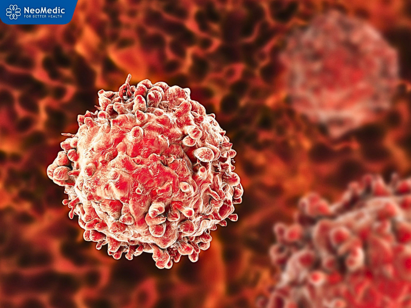 tam-soat-ung-thu-bao-lau-1-lan-4