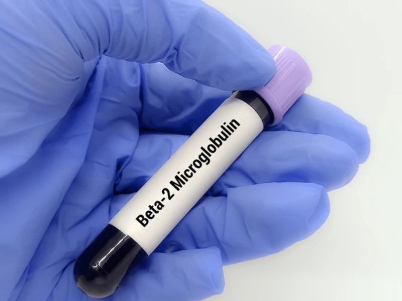 beta-2-microglobulin-1