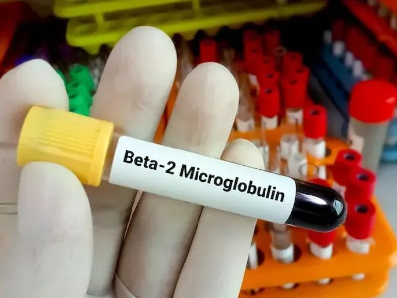 beta-2-microglobulin-3