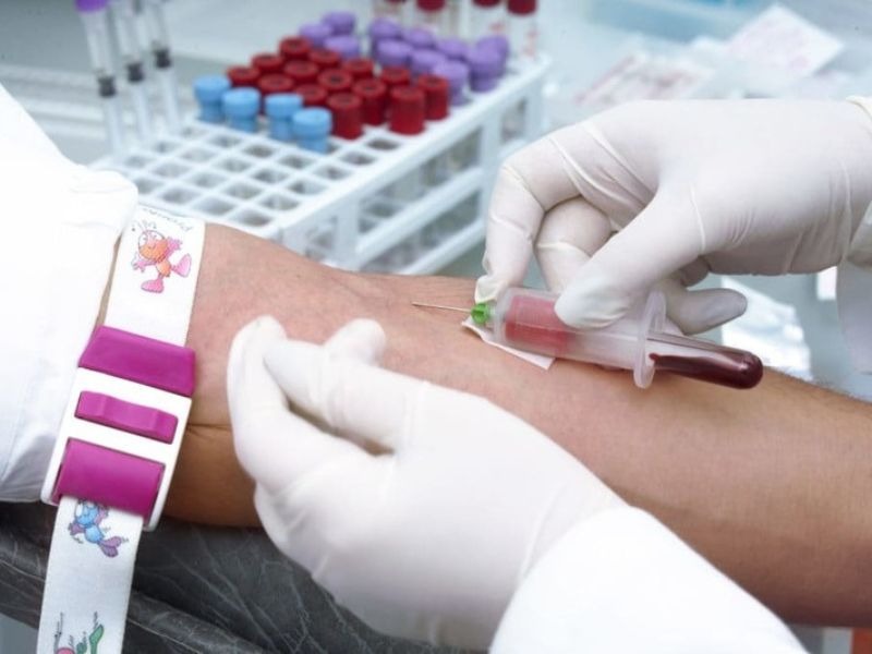 beta-2-microglobulin-4