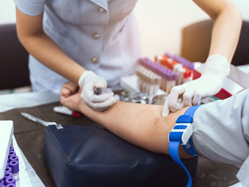 beta-2-microglobulin-5