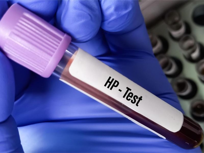 xet-nghiem-ung-thu-da-day-2