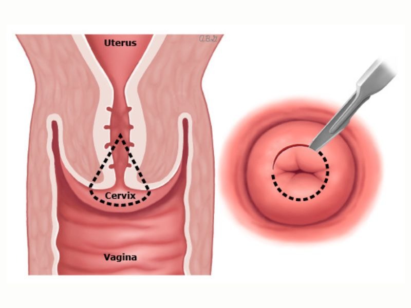 sinh-thiet-co-tu-cung-3