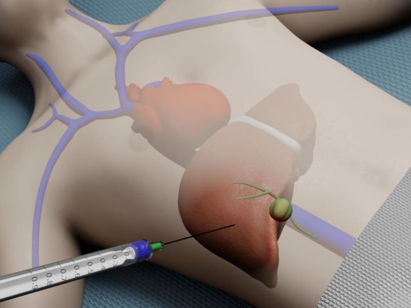 xet-nghiem-sinh-thiet-bao-nhieu-tien-1