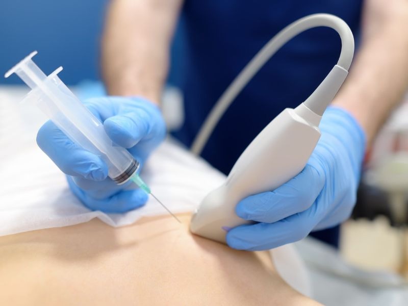 sinh-thiet-bao-lau-co-ket-qua-2