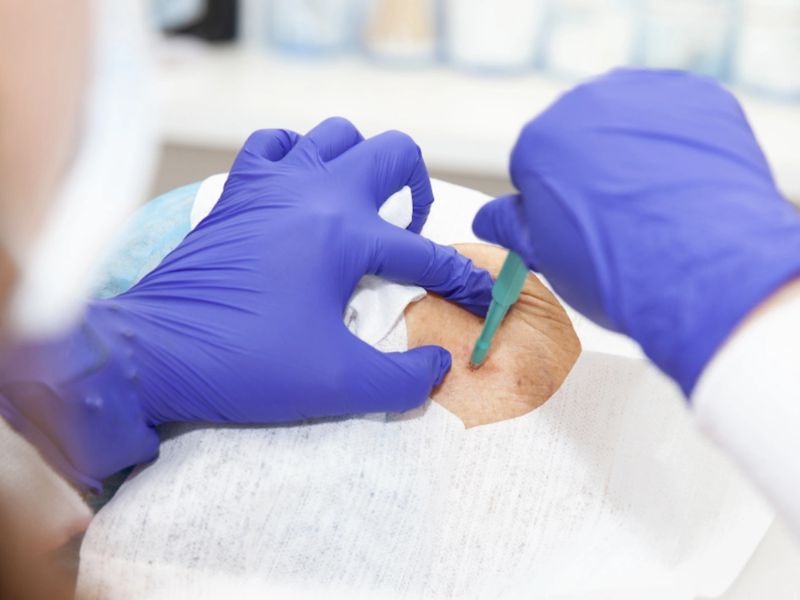 lay-sinh-thiet-co-nguy-hiem-khong-1