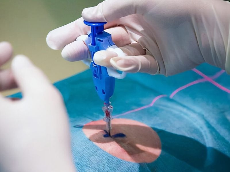 lay-sinh-thiet-co-nguy-hiem-khong-3