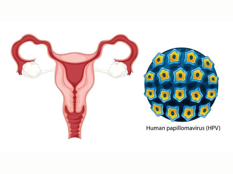 hpv-type-66-co-nguy-hiem-khong-3