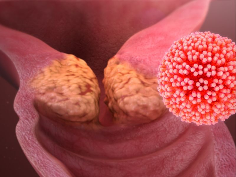 hpv-type-66-co-nguy-hiem-khong-2