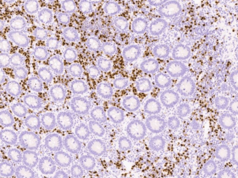 hoa-mo-mien-dich-ki67-1