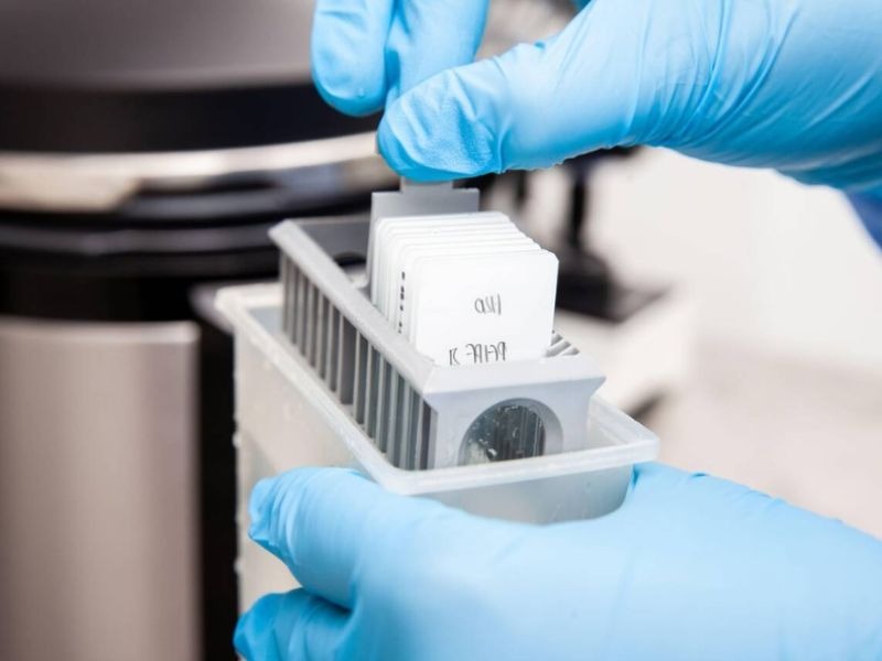 cach-doc-ket-qua-hoa-mo-mien-dich-2