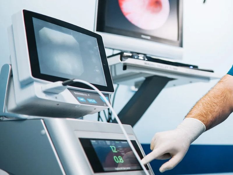 kham-tong-quat-co-phat-hien-ung-thu-khong-2