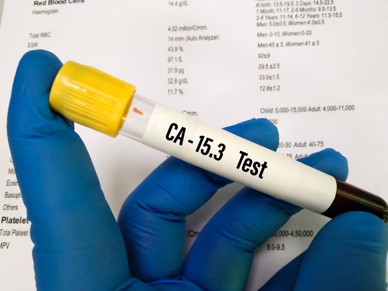 marker-ung-thu-vu-1