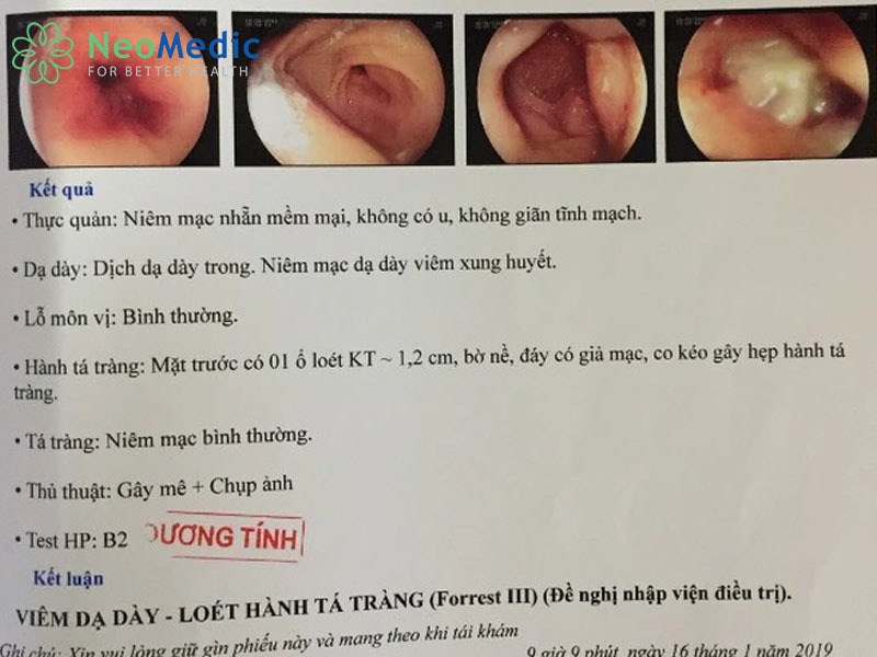 doc-ket-qua-quy-trinh-noi-soi-da-day