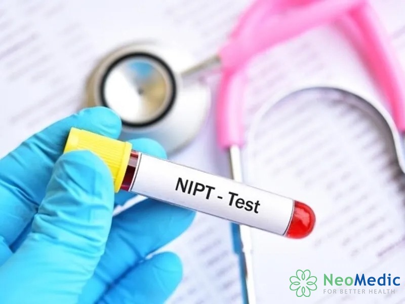 xet-nghiem-nipt-nhu-the-nao