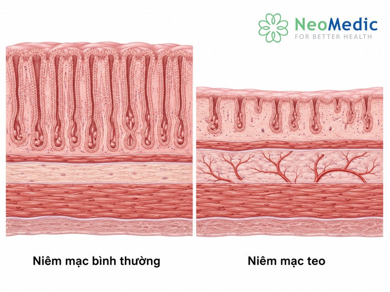 viem-teo-niem-mac-da-day