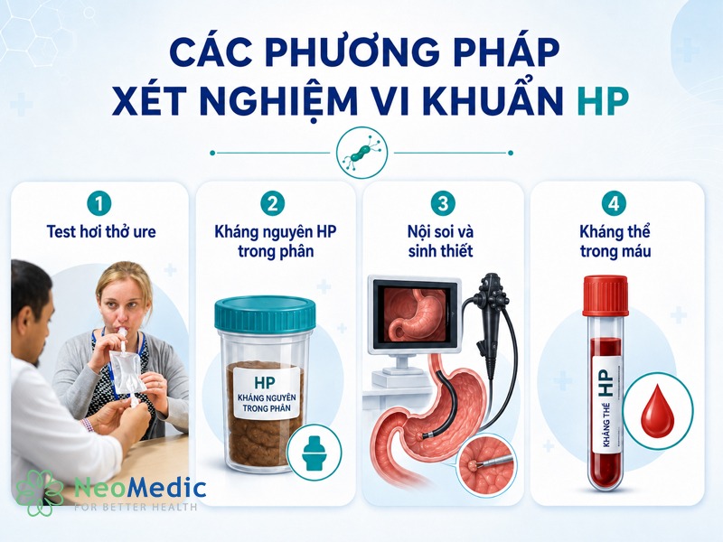xet-nghiem- vi-khuan-hp